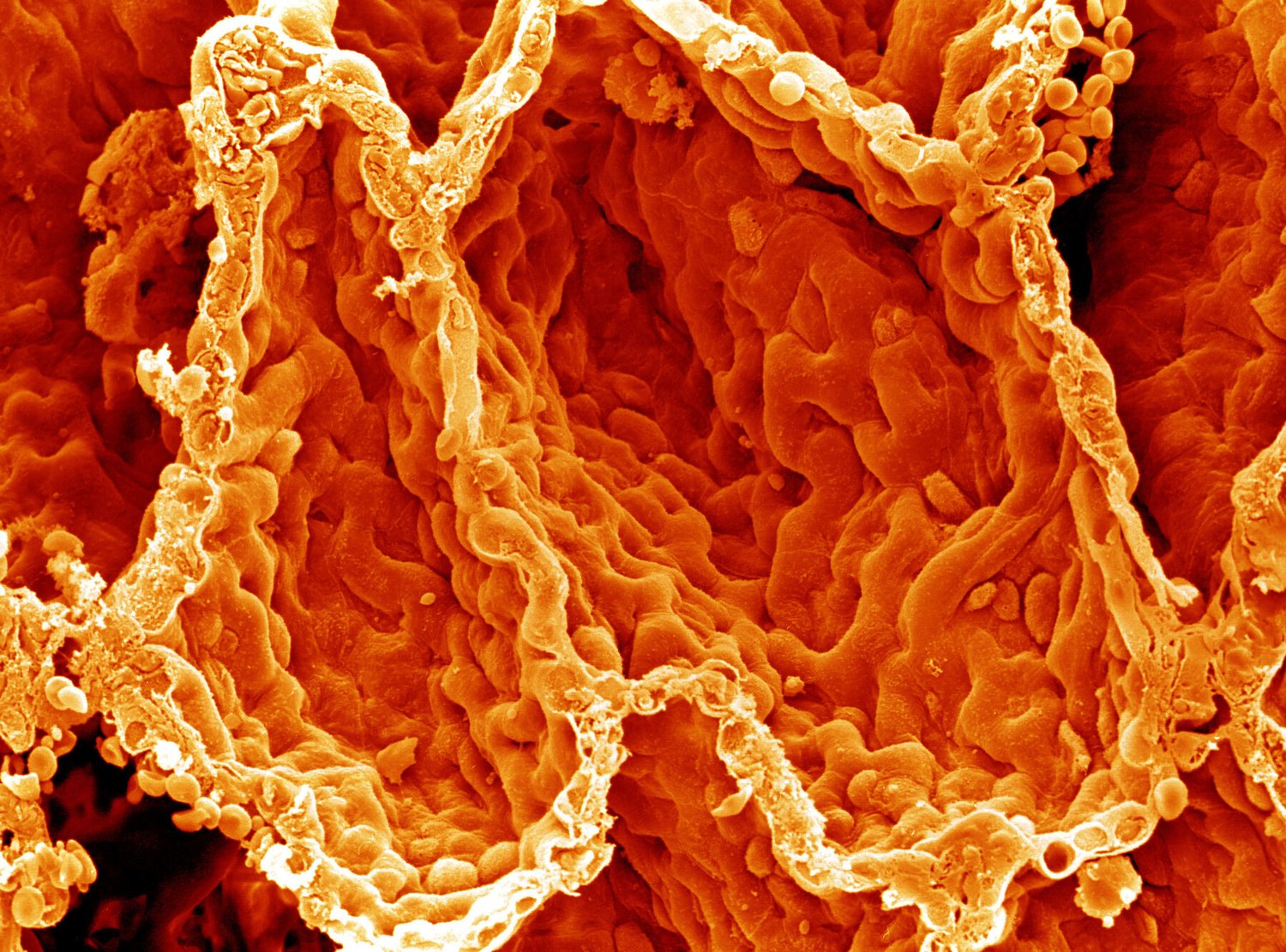 Alveolar spaces, close-up, SEM